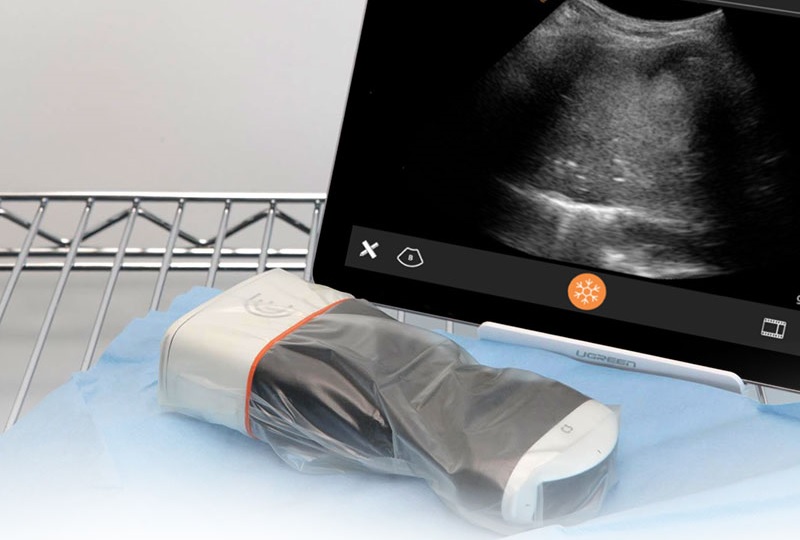 Jak działają ultrasonografy i jakie są ich rodzaje?